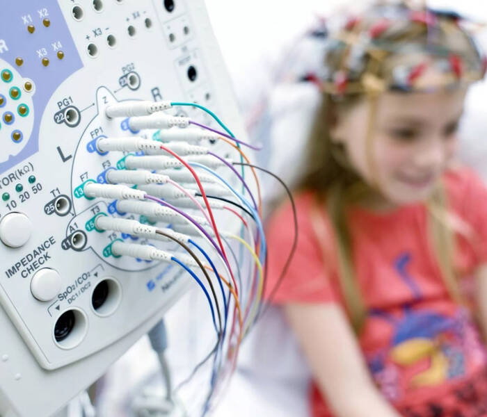 ЭЭГ в детском возрасте – важное исследование работы коры головного мозга