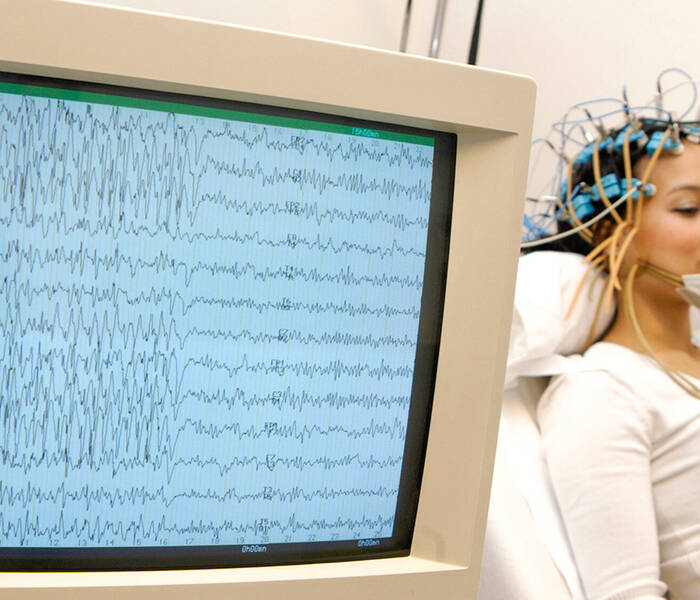 ЭЭГ мониторинг – точное и раннее обнаружение неврологических патологий